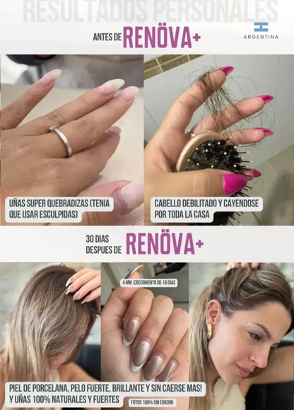 RENOVA PLAS